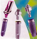 Dental Implant / Tooth Implant