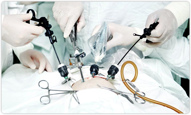 Minimally Invasive Surgery (MIS)