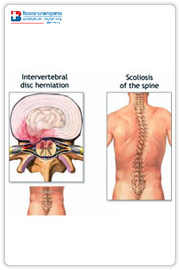 Spinal injection