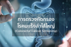 การตรวจคัดกรองโรคมะเร็งลำไส้ใหญ่ (Colorectal Cancer Screening)