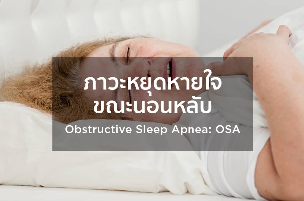 ภาวะหยุดหายใจขณะนอนหลับ (Obstructive Sleep Apnea: OSA)