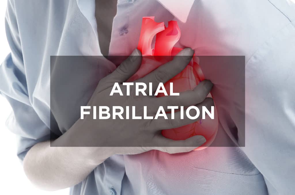 Atrial fibrillation
