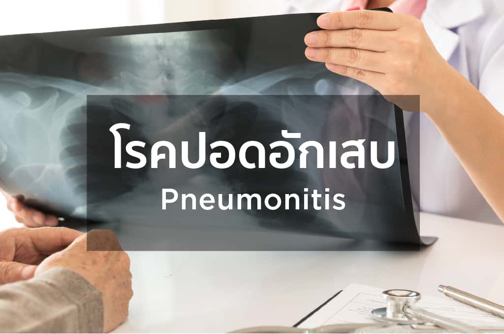 โรคปอดอักเสบ
