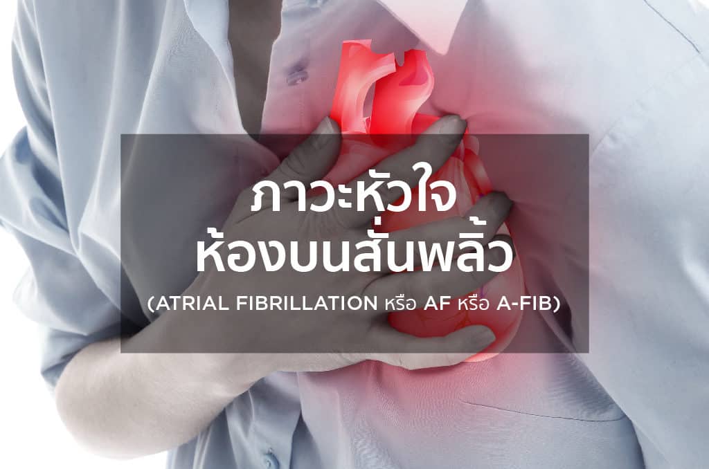 ภาวะหัวใจห้องบนสั่นพลิ้ว