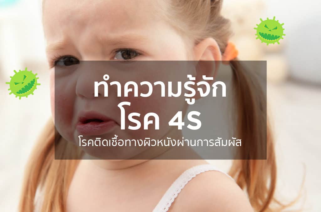 โรค 4S (Staphylococcal Scalded Skin Syndrome : SSSS)