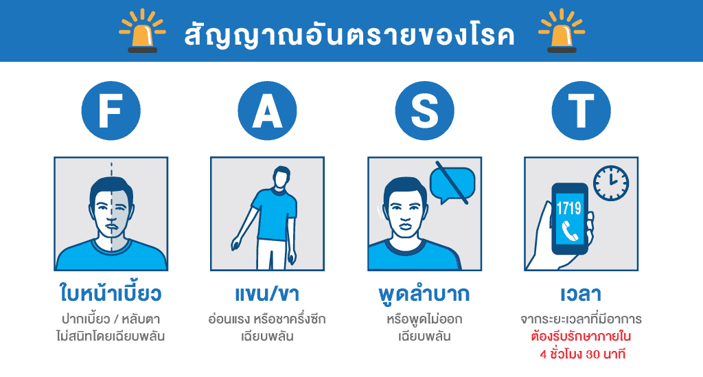 โรคหลอดเลือดสมอง