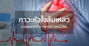 ภาวะหัวใจล้มเหลว (Congestive Heart Failure)