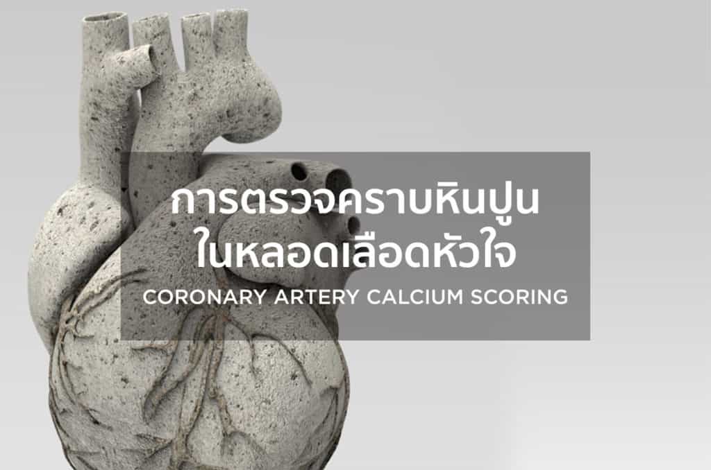 การตรวจคราบหินปูนในหลอดเลือดหัวใจ (Coronary artery calcium scoring)