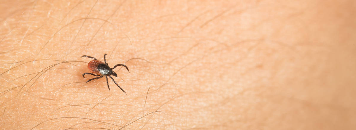 โรคลายม์