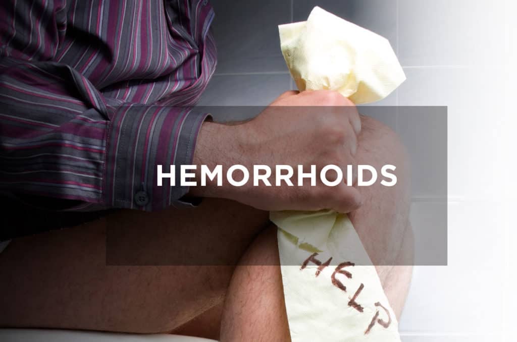 Hemorrhoids