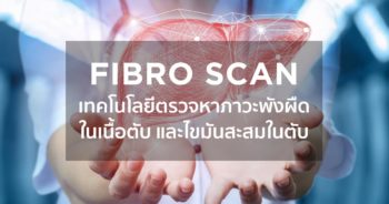 Fibro Scan เทคโนโลยีตรวจหาภาวะพังผืดในเนื้อตับ และไขมันสะสมในตับ