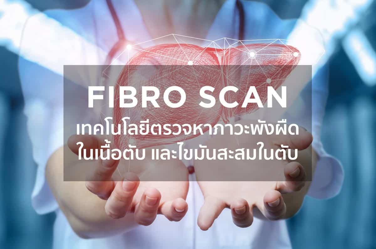 Fibro Scan เทคโนโลยีตรวจหาภาวะพังผืดในเนื้อตับ และไขมันสะสมในตับ