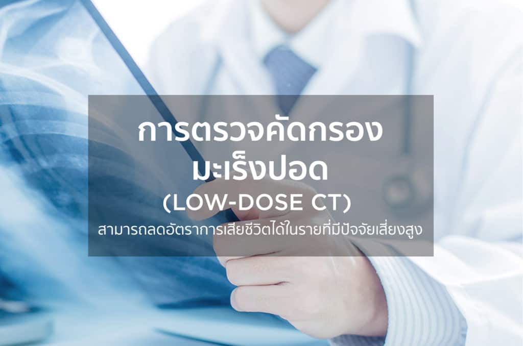 การตรวจคัดกรองมะเร็งปอด (Low-Dose CT)