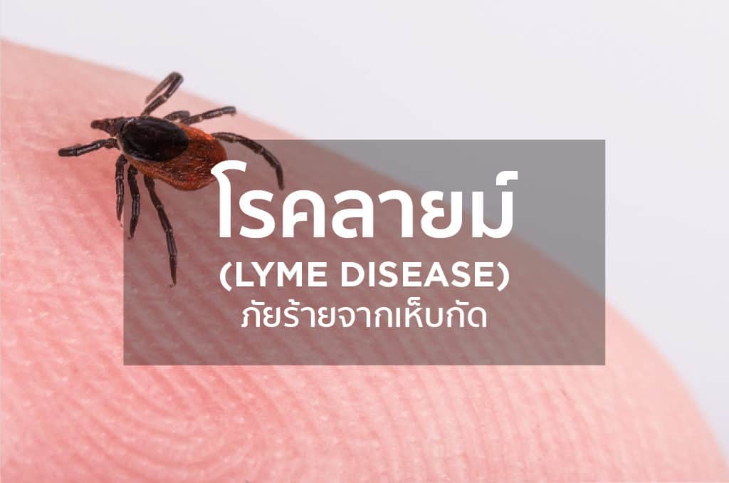 โรคลายม์ (Lyme disease) ภัยร้ายจากเห็บกัด