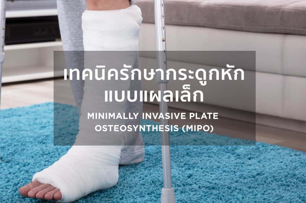 เทคนิคการรักษากระดูกหัก แบบแผลเล็ก