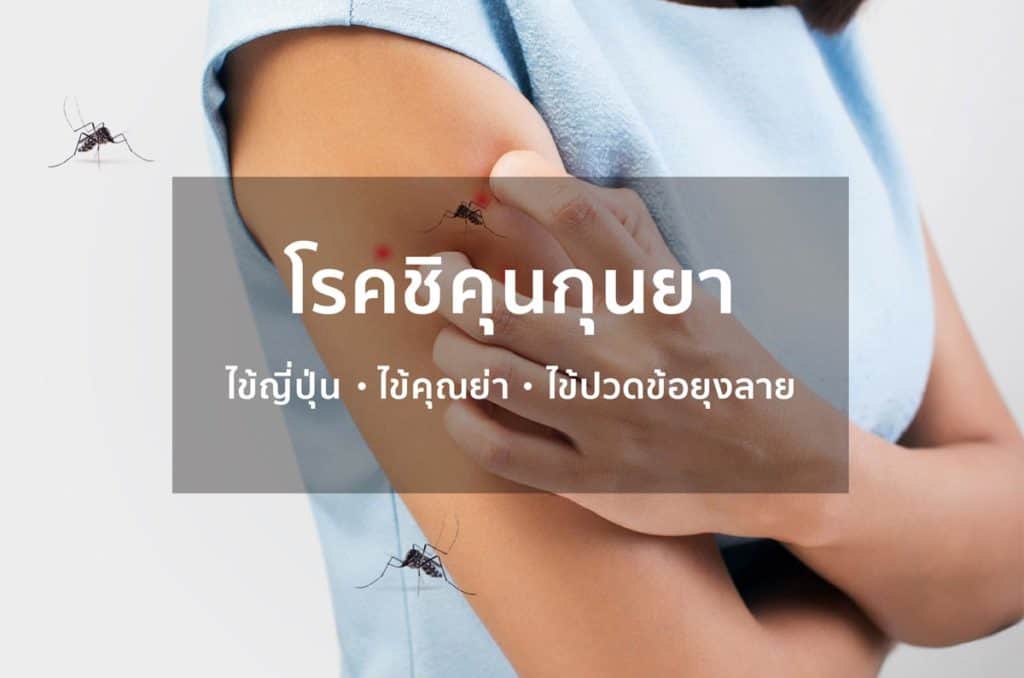 ชิคุนกุนยา