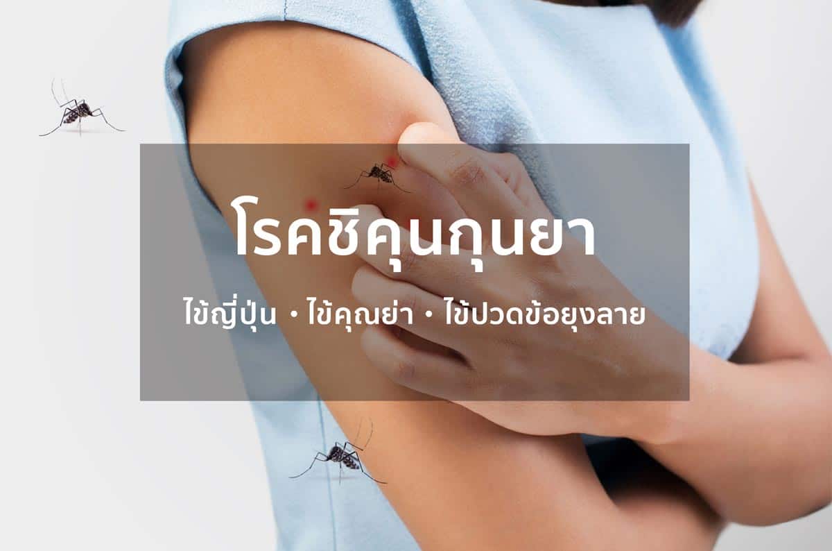 ชิคุนกุนยา