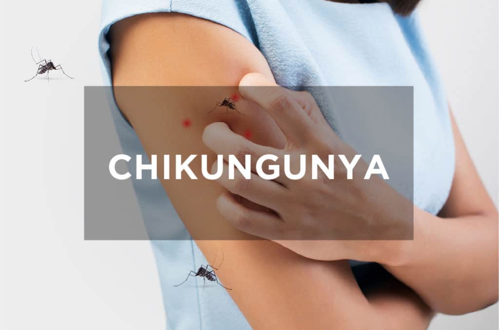 Chikungunya