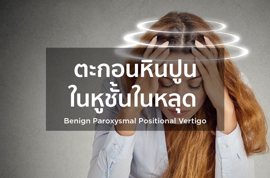 ตะกอนหินปูนในหูชั้นในหลุด