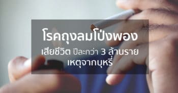 โรคถุงลมโป่งพอง