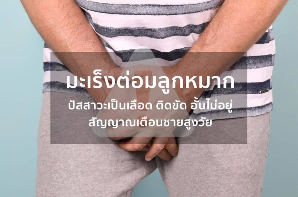 มะเร็งต่อมลูกหมาก