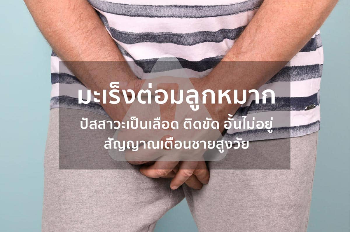 มะเร็งต่อมลูกหมาก