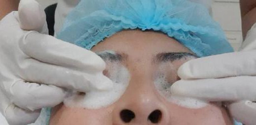 การทำความสะอาดเปลือกตา