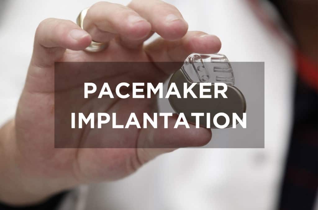 Pacemaker Implantation