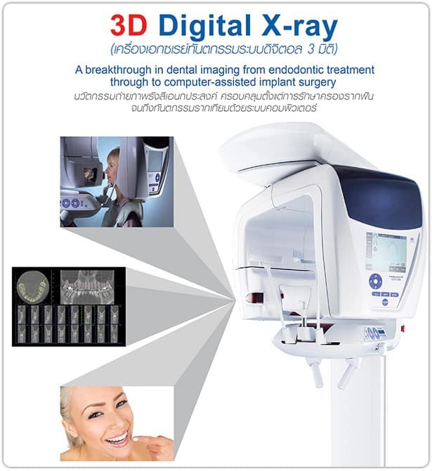 3D-Digital-X-ray