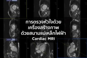 การตรวจหัวใจด้วยเครื่องสร้างภาพด้วยสนามแม่เหล็กไฟฟ้า (Cardiac MRI)