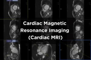 Cardiac Magnetic Resonance Imaging (MRI) scan