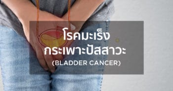 โรคมะเร็งกระเพาะปัสสาวะ