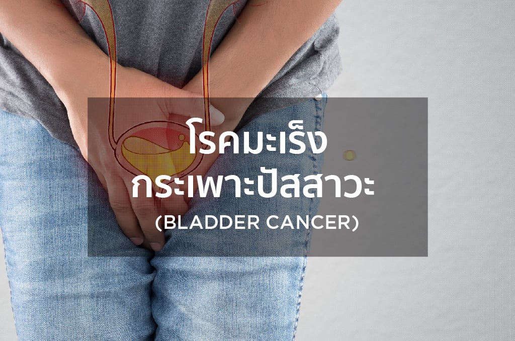 โรคมะเร็งกระเพาะปัสสาวะ