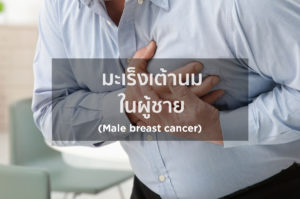 มะเร็งเต้านมในผู้ชาย