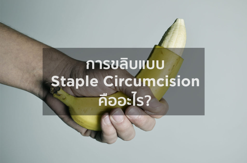 การขลิบแบบ Staple Circumcision คืออะไร