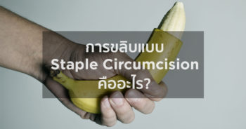 การขลิบแบบ Staple Circumcision คืออะไร
