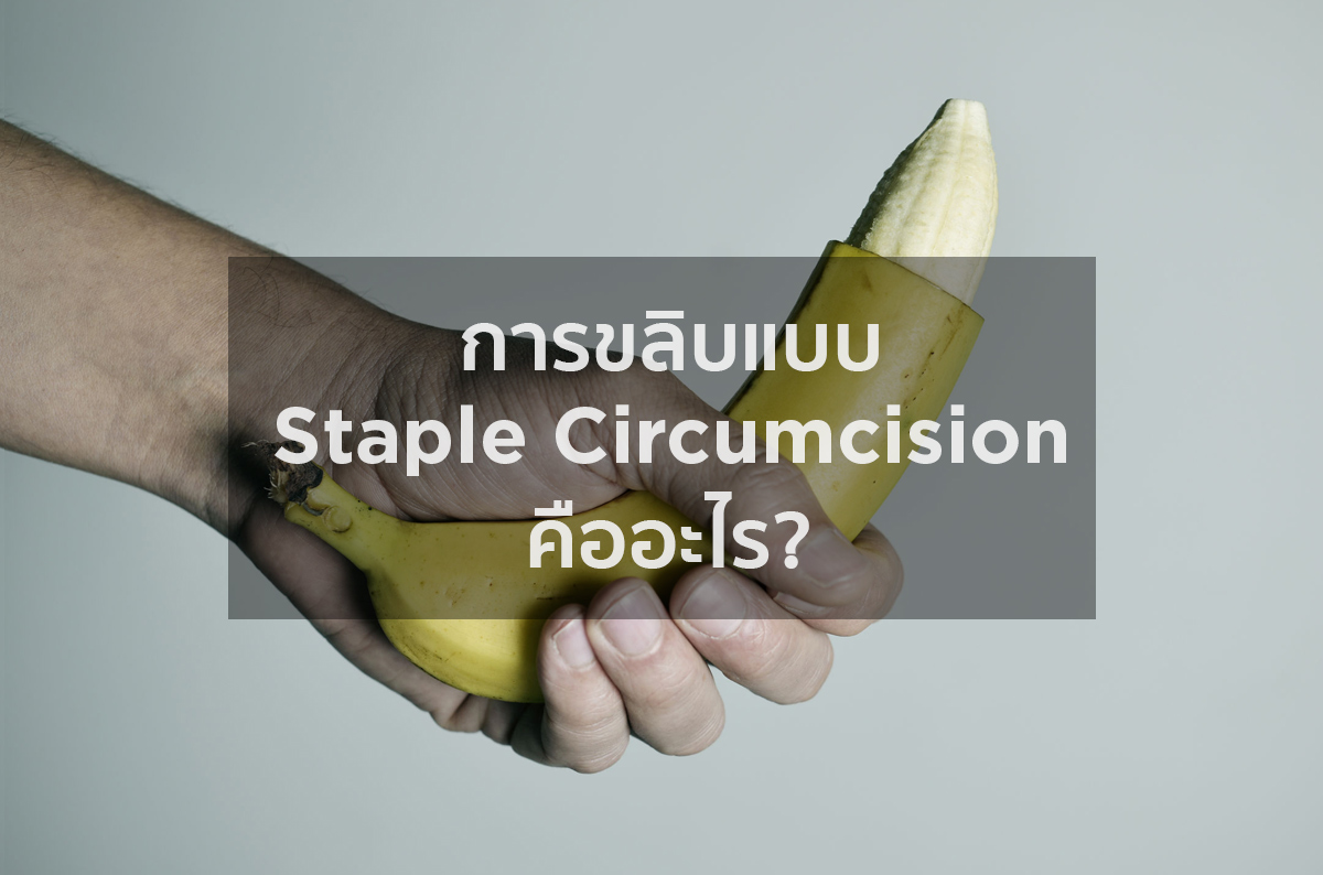 การขลิบแบบ Staple Circumcision คืออะไร