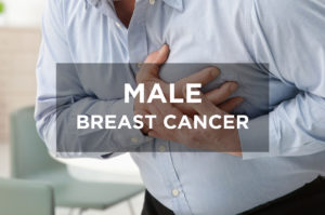 Male Breast Cancer