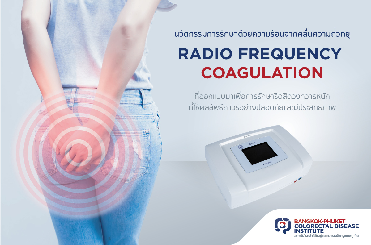 นวัตกรรมการรักษาด้วยความร้อนจากคลื่นความถี่วิทยุ
