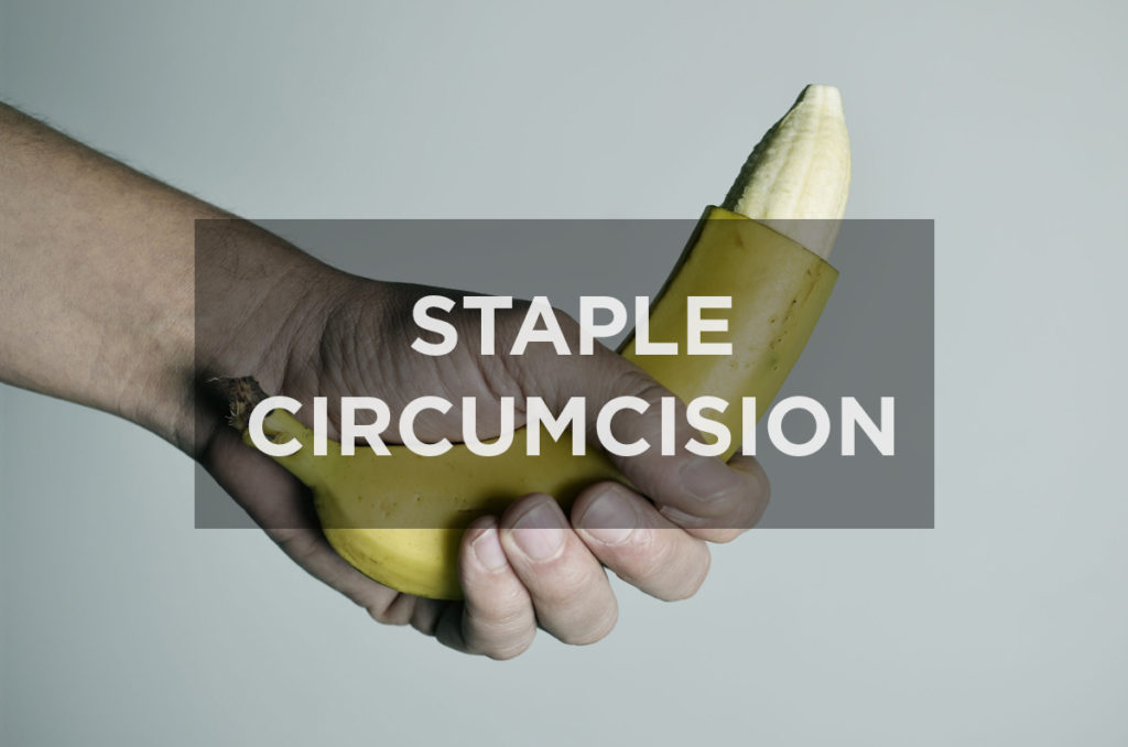What is Staple Circumcision?