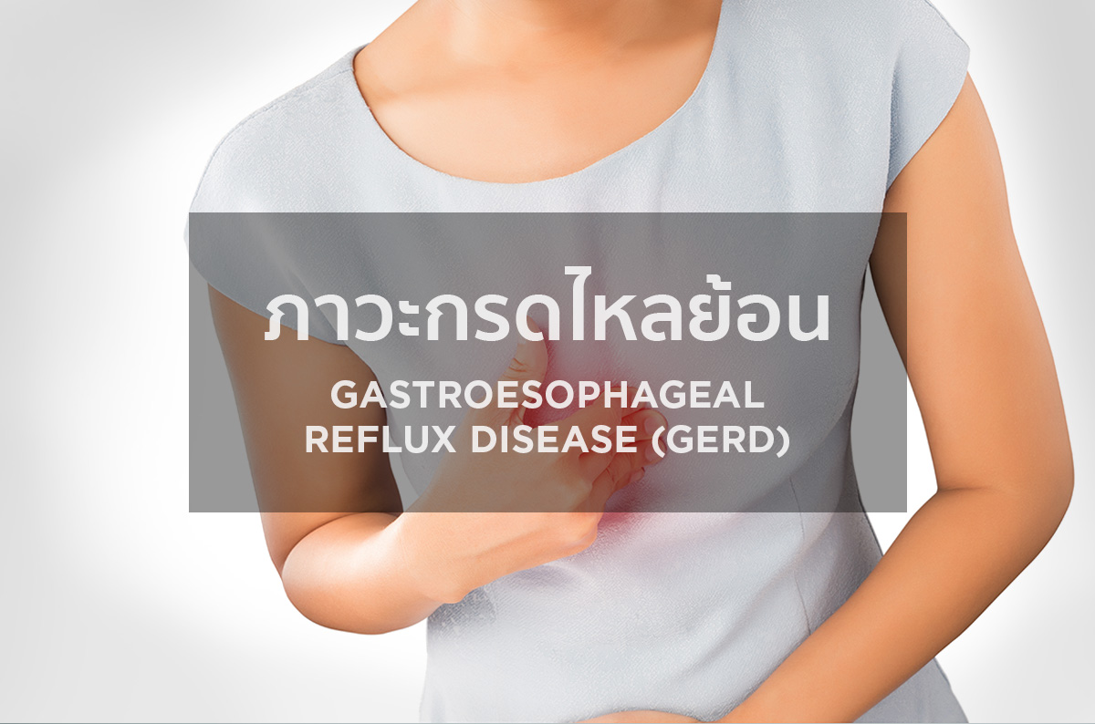 ภาวะกรดไหลย้อน Gastroesophageal Reflux Disease (GERD)
