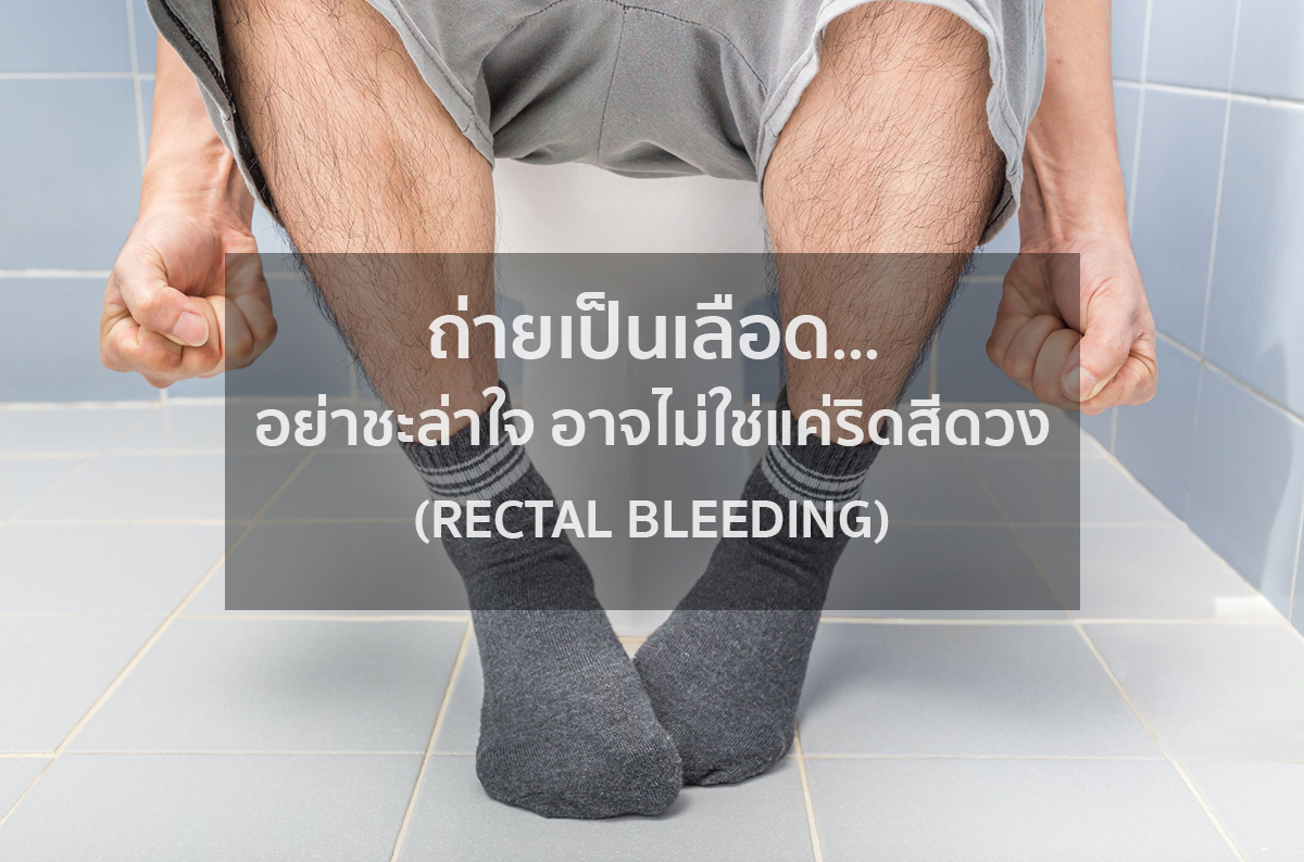 Rectal Bleeding