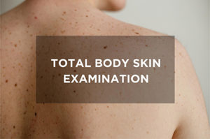 Skin Cancer: What cancer Screening is all about? Total Body Skin Examination (TBSE) People should be mindful of changes in their skin, such as a new mole or a change to an existing mole, and inform their doctor immediately. During a Total Body Skin exam, the specialist will comprehensively check for moles or uncommon conditions on your skin's surface. It is suggested to have a total body skin exam at least once per year. Clinical skin exams are beneficial in early detection of skin cancers, such as melanoma, the lethal form of skin cancer. WHAT TO EXPECT FROM A TBSE? Expect 10 to 20 minutes’ appointment including a review of your medical history and a head-to-toe skin examination. This is your chance to ask any suspicious areas on your skin you may be worried about. If there are any suspicious findings and any pertinent personal and family history, your doctor will recommend a follow-up appointment. How do I know if I should get a Total Body Skin Examination (TBSE)? If you have the following: • Fair skin • Sunburn • Personal history of Skin Cancer • Freckles • Moles • Family history of Skin Cancer Any changing (growing, change in color) mole Any symptomatic (itching, bleeding, burning) moles These are some, but not all, of the symptoms that you may need a TBSE. Patients with a personal or family history of skin cancer (specifically melanoma) will need more repeated TBSEs. Reference: https://www.dermskin.com/skin-exams https://www.kassirdermatology.com/general-dermatology/total-body-skin-exam/
