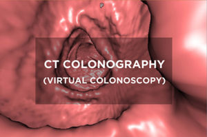 CT Colonography (Virtual Colonoscopy)