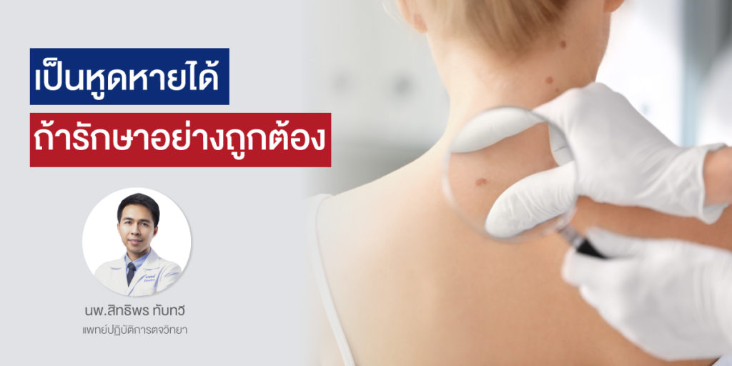 เป็นหูดหายได้ ถ้ารักษาอย่างถูกต้อง