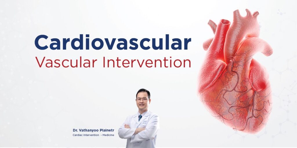 Cardiovascular Vascular Intervention