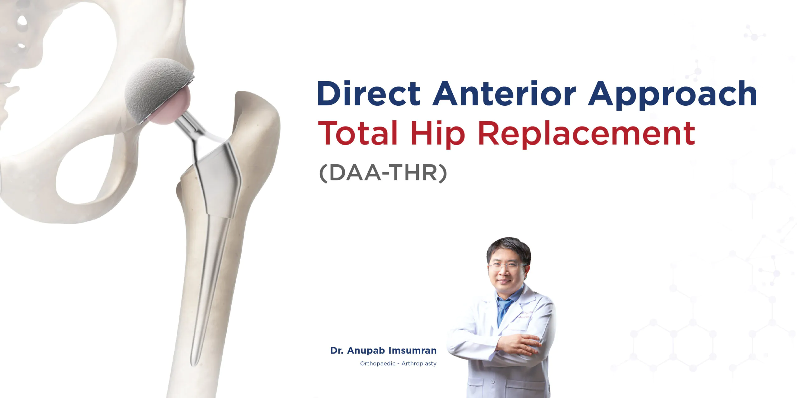 Direct Anterior Approach Total Hip Replacement (DAATHR) Bangkok